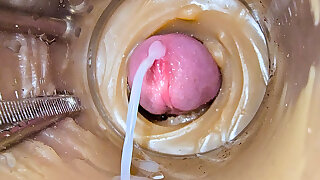 Camera Inside Deep Captures Huge Ejaculation of Sperm 2 Times